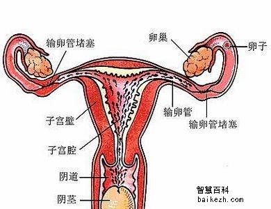 输卵管异常，可致使不孕