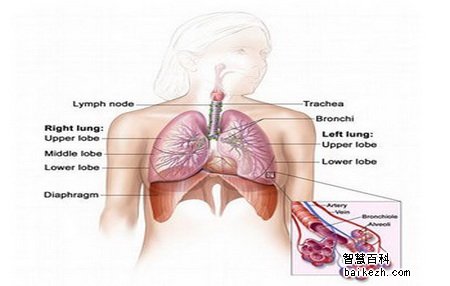 胸膜内肺松解术治疗的优点