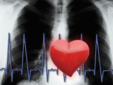 慢性肺源性心脏病