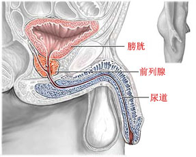 前列腺囊肿采用何种手术方式为最好