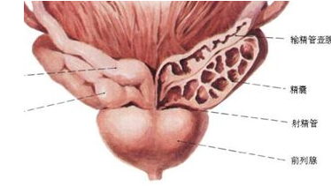 前列腺囊肿在临床上有哪些分类