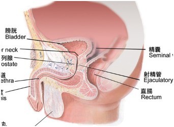 前列腺钙化的主要鉴别诊断