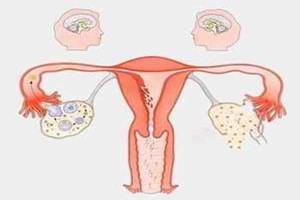 输卵管阻塞是怎么回事？