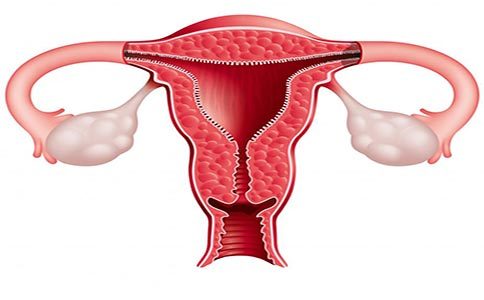 子宫内膜异位症研究可以分为几个阶段