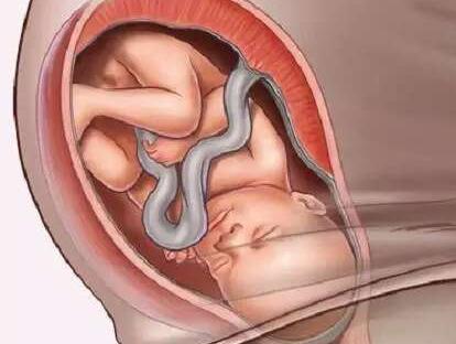胎儿入盆会出现哪些症状表现
