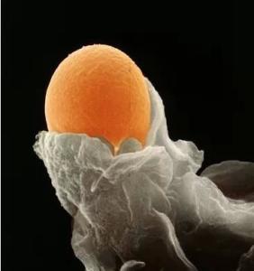 怎样培养优质卵泡