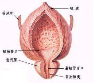 前列腺结核特征及膳食方