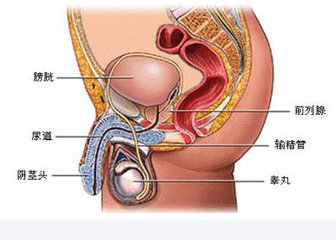 前列腺结核的病因是什么呢