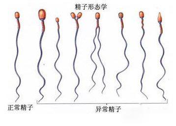 精液异常除了导致男性不育外，还有哪些危害