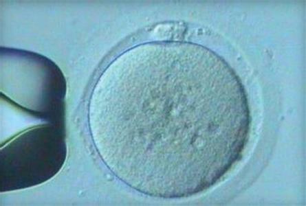 卵子排出多久受精及排出的症状