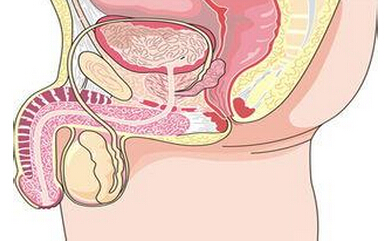 久坐可导致阴囊瘙痒，它的饮食疗法是什么