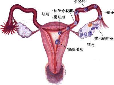 输卵管积液的危害及预防和治疗
