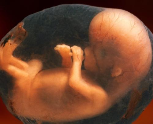胎儿先天畸形的原因及处理和预防方法