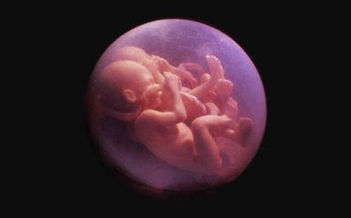 孕三个月胎停的原因及症状和注意事项