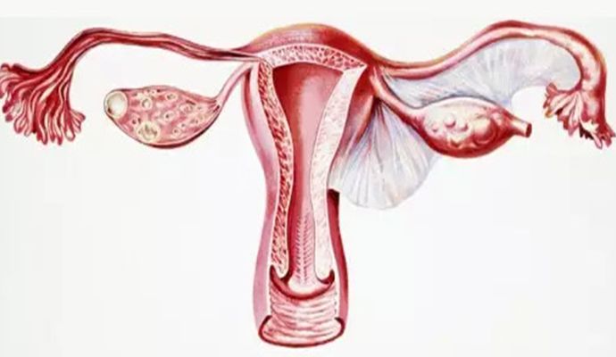 子宫颈癌的早期症状及中医治疗方法和预防