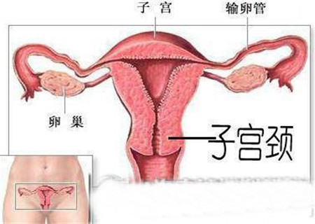 女性宫颈炎的症状有哪些