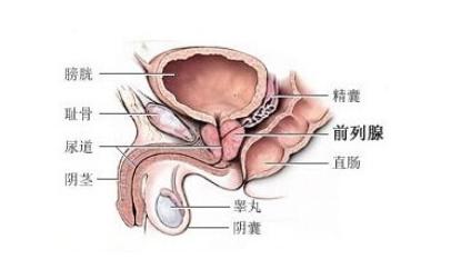 前列腺增生常见病症及防治方法和日常调理