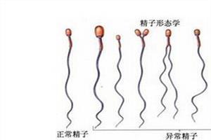 精子的形态和畸形精子的状态及形成原因