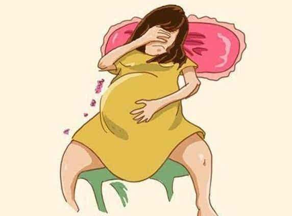 孕妇痔疮的原因与症状?如何预防孕妇痔疮