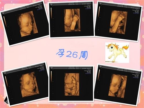 孕妈妈做四维彩超去内江哪个医院?