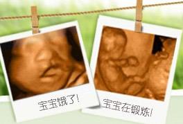 内江5个月胎儿四维彩超变化