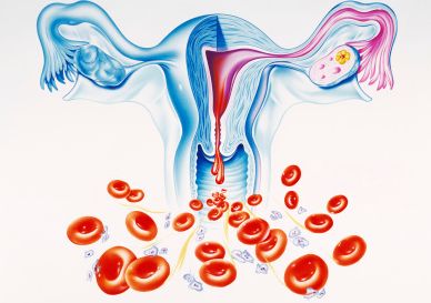 一侧输卵管通而不畅能怀孕？导致原因和检查项