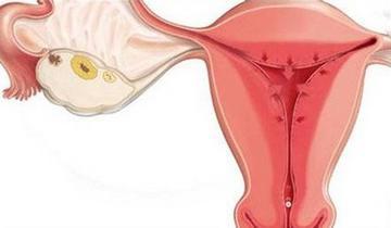 子宫内膜增厚的症状 子宫内膜增厚有什么危害
