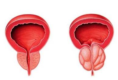 男人前列腺的四大功能