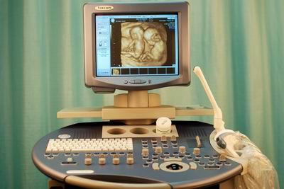 四维彩超检查什么？对胎儿有影响吗？