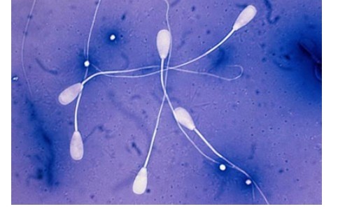 精子不液化能生孩子吗