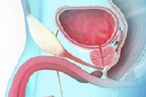 前列腺增生病发因素都有哪些呢？