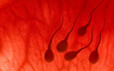 精囊炎引起的血精是什么原因？你了解精囊炎吗？